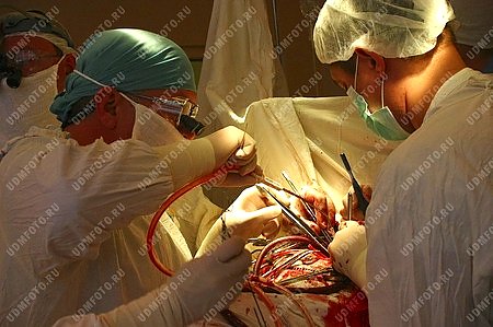 медицина,хирург,операция,детская кардиология
